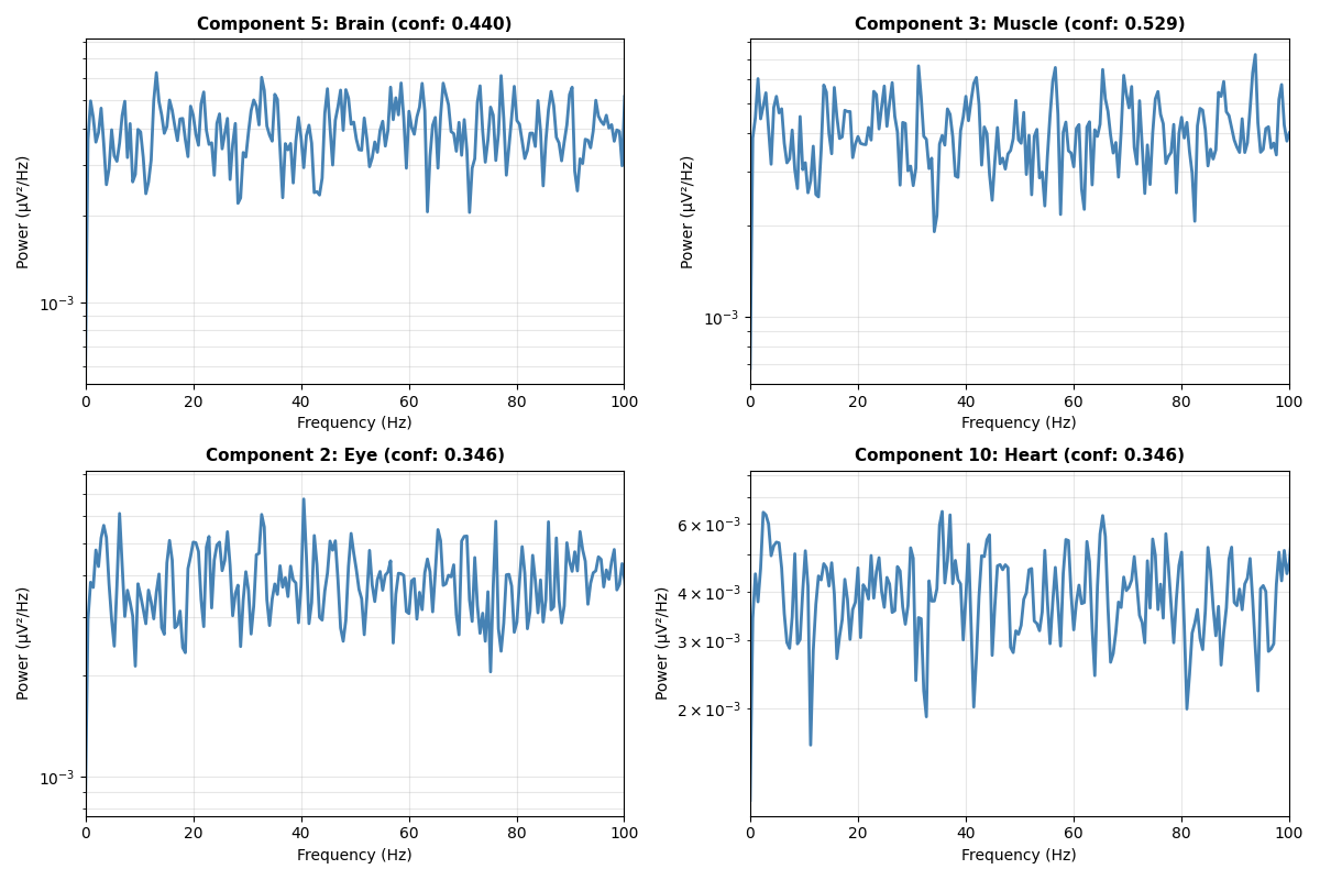 Component 5: Brain (conf: 0.440), Component 3: Muscle (conf: 0.529), Component 2: Eye (conf: 0.346), Component 10: Heart (conf: 0.346)